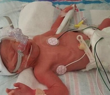 O asistenta a adormit cu un bebelus in brate, l-a scapat pe jos si i-a spart capul. Mama a aflat de situatie la externare