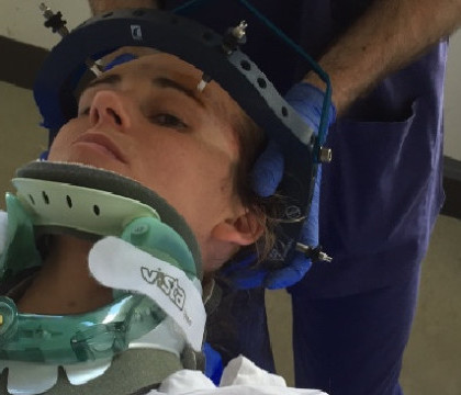 O femeie din Australia si-a fracturat gatul dupa ce a stranutat. Ce s-a intamplat la o diferenta de 5 ani, dupa ce a ras. FOTO O femeie din Australia si-a fracturat gatul dupa ce a stranutat. Ce s-a intamplat la o diferenta de 5 ani, dupa ce a ras. FOTO