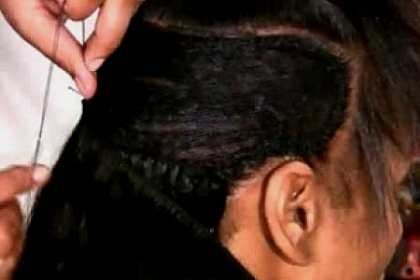 Si-a pus extensii de par la un salon. Ce s-a intamplat cu aceasta femeie dupa 2 saptamani