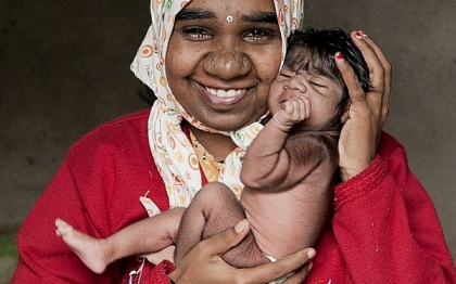 Un nou bebelus s-a nascut in "Familia Varcolac" din India. "Dumnezeu ne-a facut asa" Un nou bebelus s-a nascut in "Familia Varcolac" din India. "Dumnezeu ne-a facut asa"