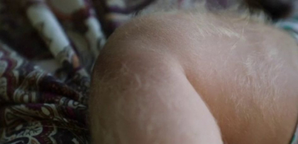 Le-au dat copiilor un sirop contra refluxului gastric, dar efectele au fost devastatoare