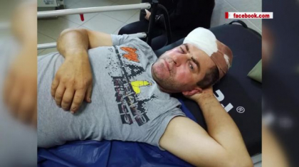 Politia vine cu precizari privind cazul de la Causeni unde un candidat la functia de consilier de pe lista partidului Democratia Acasa a fost batut cu cruzime. Vecinul acestuia recunoaste ca l-a lovit si povesteste cum s-a intamplat totul 
