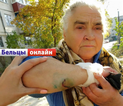 O pensionara de 78 de ani din Balti, muscata de trei caini vagabonzi - FOTO O pensionara de 78 de ani din Balti, muscata de trei caini vagabonzi - FOTO