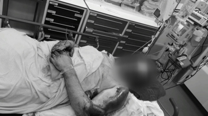 Un moldovean, in stare extrem de grava la un spital din Londra, dupa ce o duba a trecut peste el si l-a tarat cativa metri. Familia cere ajutor pentru a-i salva viata Un moldovean, in stare extrem de grava la un spital din Londra, dupa ce o duba a trecut peste el si l-a tarat cativa metri. Familia cere ajutor pentru a-i salva viata