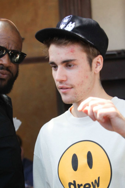 Anuntul soc facut de Justin Bieber. De ce boala sufera artistul Anuntul soc facut de Justin Bieber. De ce boala sufera artistul