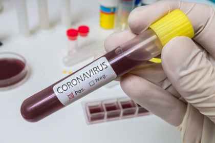 Bilantul epidemiei de coronavirus a ajuns la peste 2.000 de morti si 75.000 de imbolnaviri Bilantul epidemiei de coronavirus a ajuns la peste 2.000 de morti si 75.000 de imbolnaviri