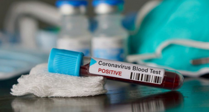 Inca o moldoveanca, aflata in Italia, este infectata cu coronavirus. Ce spun responsabilii de la Ministerul de Externe de la noi Inca o moldoveanca, aflata in Italia, este infectata cu coronavirus. Ce spun responsabilii de la Ministerul de Externe de la noi
