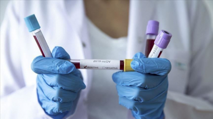 Un copil revenit din Italia, suspectat de COVID-19. Minorul a fost internat la Spitalul de boli infectioase pentru copii cu febra si tuse Un copil revenit din Italia, suspectat de COVID-19. Minorul a fost internat la Spitalul de boli infectioase pentru copii cu febra si tuse