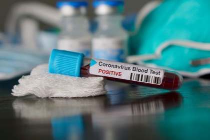 Epidemie de coronavirus: Stare de urgenta in California, unde sunt 53 de cazuri confirmate Epidemie de coronavirus: Stare de urgenta in California, unde sunt 53 de cazuri confirmate
