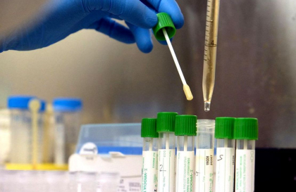 Italia apeleaza la un tratament experimental, pentru a scapa de coronavirus! Primele rezultate sunt incurajatoare Italia apeleaza la un tratament experimental, pentru a scapa de coronavirus! Primele rezultate sunt incurajatoare