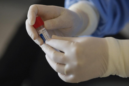 Coronavirus in Romania: Alte 19 cazuri noi / Bilantul imbolnavirilor - 158