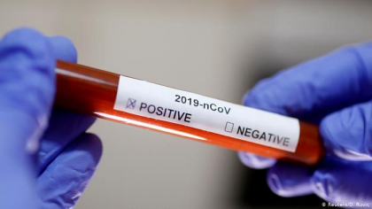 Coronavirus in Republica Moldova: Cum se da testul de supravietuire?