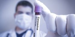 Un lot de 500 de teste pentru depistarea coronavirusului - donate de un agent economic. Testele vor fi acordate medicilor care stau in prima linie