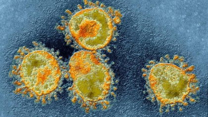 Inca un deces cauzat de coronavirus in Romania. Bilantul ajunge la 30 de morti
