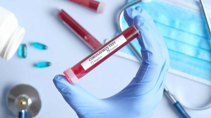 Republica Moldova va cumpara 100 de mii de teste pentru coronavirus din China