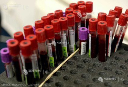 Test de sange care ''poate detecta mai mult de 50 de tipuri de cancer'' Test de sange care ''poate detecta mai mult de 50 de tipuri de cancer''