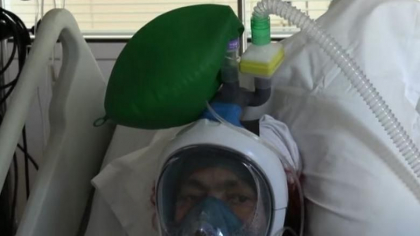 Din cauza lipsurilor, medicii francezi inventeaza si se adapteaza: echipamente pentru scufundari, transformate in ventilatoare - VIDEO