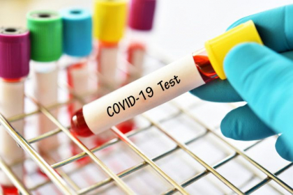 Coronavirus in lume. UPDATE 8 aprilie. La nivel global decesele se apropie de 80.000