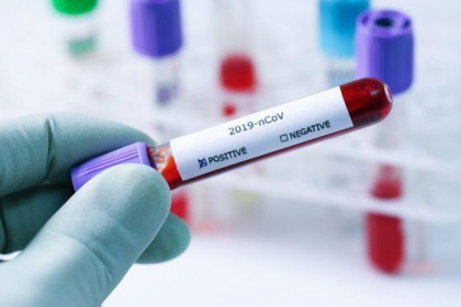 O pacienta infectata cu Covid-19 a fugit din spital. Aceasta este cautata de politie O pacienta infectata cu Covid-19 a fugit din spital. Aceasta este cautata de politie