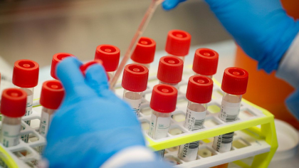 Sefa de laborator din cadrul Spitalului de Boli Infectioase "Toma Ciorba" - testata pozitiv la coronavirus