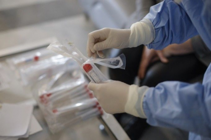 15 pacienti cu coronavirus sunt conectati la aparatul de respiratie artificiala. Care este starea de sanatate a celorlalti pacienti 15 pacienti cu coronavirus sunt conectati la aparatul de respiratie artificiala. Care este starea de sanatate a celorlalti pacienti