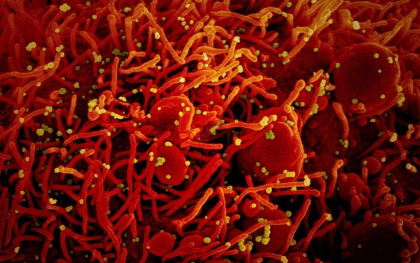 Pandemia Covid-19 in cifre. Ce s-a intamplat cu tarile care au ridicat restrictiile rapid Pandemia Covid-19 in cifre. Ce s-a intamplat cu tarile care au ridicat restrictiile rapid