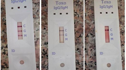 In farmaciile moldovenesti se vand teste pentu depistarea coronavirusului de tip nou. Ce spun medicii In farmaciile moldovenesti se vand teste pentu depistarea coronavirusului de tip nou. Ce spun medicii