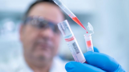 Studiul care da peste cap sperantele ca noul coronavirus va disparea pe timpul verii
Studiul care da peste cap sperantele ca noul coronavirus va disparea pe timpul verii