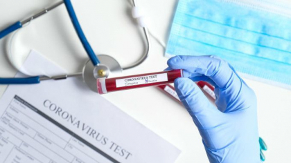 Ultima ora. 147 cazuri noi de infectie cu COVID-19 confirmate in Moldova. Numarul total de persoane infectate - 6 994