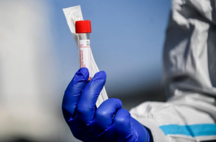 Oamenii de stiinta abia incep sa inteleaga numeroasele probleme de sanatate cauzate de COVID-19 Oamenii de stiinta abia incep sa inteleaga numeroasele probleme de sanatate cauzate de COVID-19