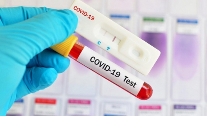 Romania atinge un nou record al infectiilor cu Covid-19