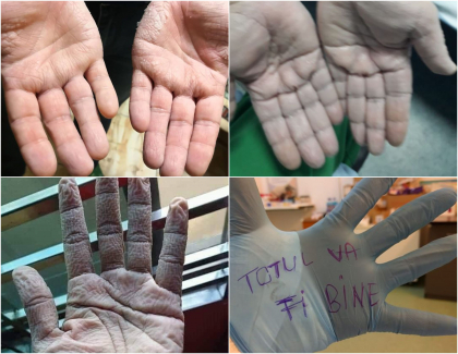 Imagini greu de privit cu medicii care poarta combinezoane anti Covid-19. Cum arata mainile lor - FOTO Imagini greu de privit cu medicii care poarta combinezoane anti Covid-19. Cum arata mainile lor - FOTO