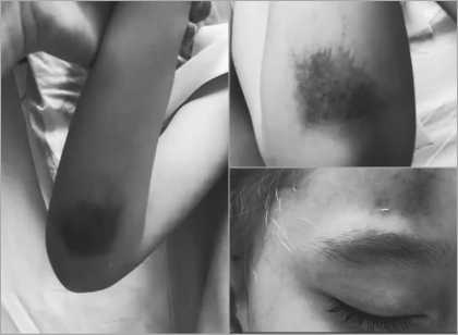 "Cei care se deplaseaza cu viteza excesiva sa fie amendati". Ion Ceban, despre accidentul din parcul Valea Trandafirilor, cand o fetita a fost lovita de un biciclist "Cei care se deplaseaza cu viteza excesiva sa fie amendati". Ion Ceban, despre accidentul din parcul Valea Trandafirilor, cand o fetita a fost lovita de un biciclist