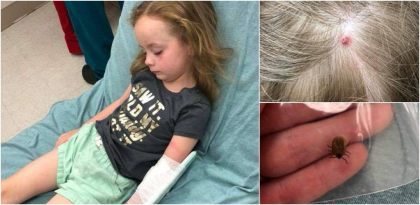 Cosmarul prin care a trecut o fetita de 5 ani, dupa ce a fost muscata de o capusa - FOTO