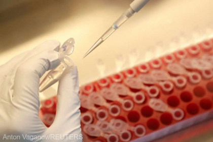 Coronavirus: Cercetatori italieni au descoperit mecanismul ce provoaca raspunsul inflamator la copiii bolnavi de COVID-19 Coronavirus: Cercetatori italieni au descoperit mecanismul ce provoaca raspunsul inflamator la copiii bolnavi de COVID-19