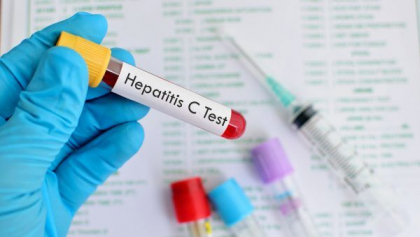A fost lansata testarea la hepatitele virale B si C. Anuntul ministerului Sanatatii A fost lansata testarea la hepatitele virale B si C. Anuntul ministerului Sanatatii