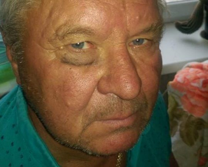 Alexandr Slusari spune ca paza lui Igor Dodon a batut un activist PPDA: "Doar pentru incercare de a participa la intrunirea cu mister culioc, batranul a fost umilit". Reactia sefului statului