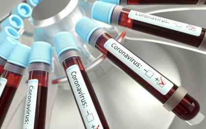 Noul simptom al infectiei cu Covid. Medicii sunt tot mai ingrijorati Noul simptom al infectiei cu Covid. Medicii sunt tot mai ingrijorati