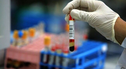 Anglia va produce un test care ar putea detecta 50 de tipuri de cancer in stadiu incipient
