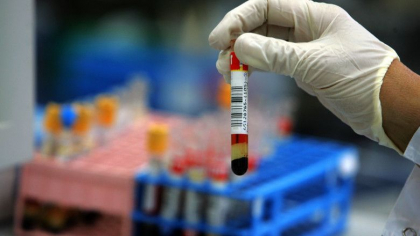 Testare in masa intr-un oras din Spania: 70% din populatie este infectata cu coronavirus Testare in masa intr-un oras din Spania: 70% din populatie este infectata cu coronavirus