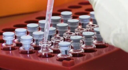 Cercetarile pentru un vaccin australian anti-Covid au fost abandonate dupa ce pacientii apareau ca s-ar fi infectat cu HIV
