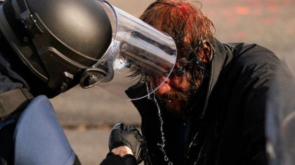 Mai multe persoane au fost ranite, dintre care 4 in stare grava, la manifestatia sustinatorilor lui Donald Trump - FOTO