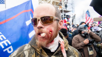 Cele mai puternice imagini de la asaltul Capitoliului. Trumpistii, plini de sange, dar decisi sa impiedice validarea lui Biden - GALERIE FOTO