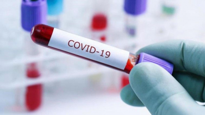 O noua explozie de cazuri de coronavirus in Moldova? Cand s-ar putea inregistra. Interviu cu Boris Gilca: "Ramanem in alerta" O noua explozie de cazuri de coronavirus in Moldova? Cand s-ar putea inregistra. Interviu cu Boris Gilca: "Ramanem in alerta"
