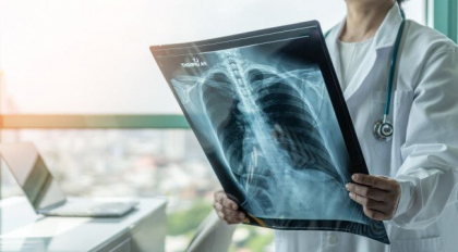 Plamanul, organul cheie in infectia cu SARS COV-2. Traseul virusului la nivel pulmonar, explicat de medicul pneumolog Plamanul, organul cheie in infectia cu SARS COV-2. Traseul virusului la nivel pulmonar, explicat de medicul pneumolog