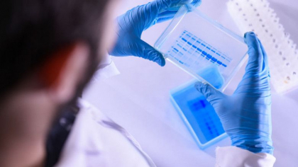 Au fost descoperite doua "variante americane" ale SARS-CoV-2. Una dintre ele a evoluat rapid in Ohio, in cateva saptamani