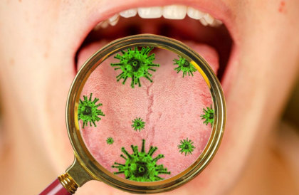 Un nou simptom al infectiei cu noul coronavirus. Ce este „limba COVID”