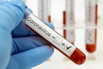 Ultima ora. Alte 282 cazuri noi de infectare cu Covid-19 au fost confirmate in Republica Moldova Ultima ora. Alte 282 cazuri noi de infectare cu Covid-19 au fost confirmate in Republica Moldova
