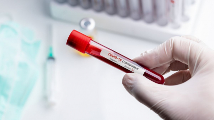 EXPLOZIE de cazuri de Covid-19 in Moldova. Tara noastra inregistreaza astazi un nou anti-record de infectari