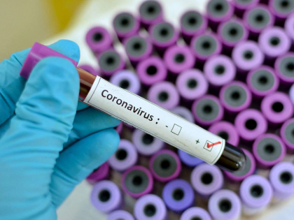 1258 cazuri de COVID-19, inregistrate in ultimele 24 ore, din peste 6 mii de teste efectuate. Vezi cate decese 